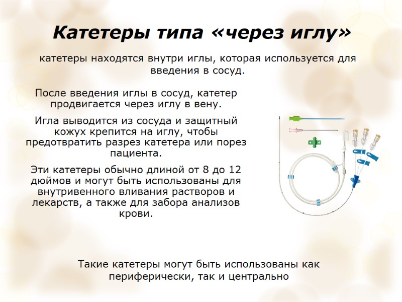 Катетеры типа «через иглу»  После введения иглы в сосуд, катетер продвигается через иглу